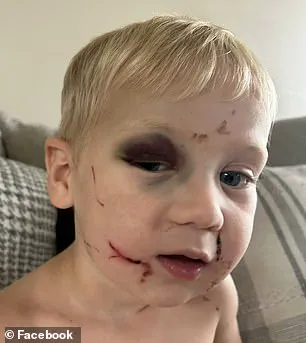 Georgia Daycare Abuse Incident Sparks Public Demand for Enhanced Childcare Safety Regulations