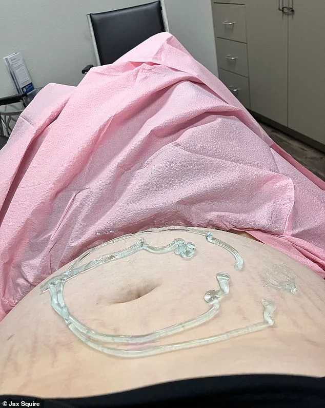 Jax Squire's Journey: A Transgender Man's Decision to Adopt His Child Amid Personal and Societal Challenges