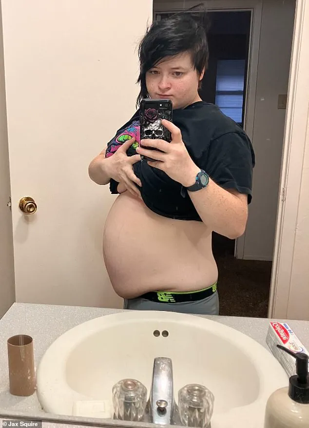 Jax Squire's Journey: A Transgender Man's Decision to Adopt His Child Amid Personal and Societal Challenges