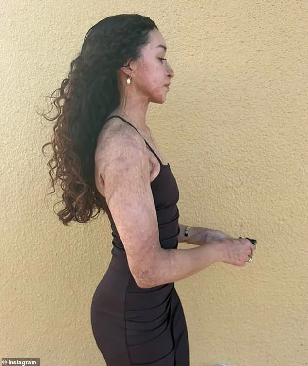 Bodybuilder Davina Licon Survives Armed Attack at Hawaii Gym, Suffers Injuries