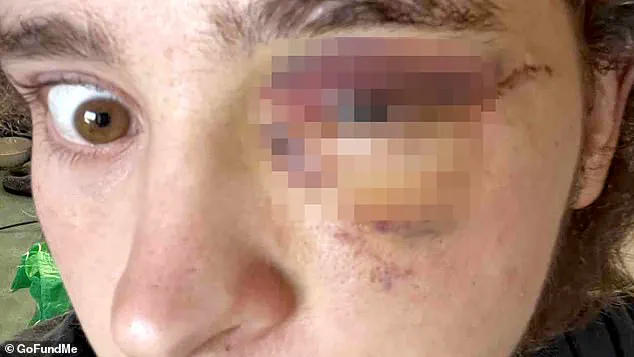 Violent Confrontation Erupts at Southern California ICE Protest, Demonstrator Allegedly Injured and Debate Over Law Enforcement Use of Force Intensifies