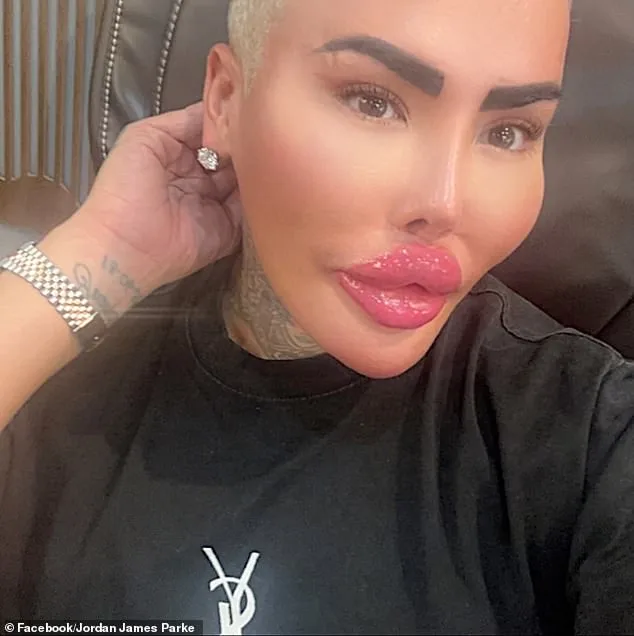 Two Arrested in Manslaughter Case of Botched Star 'The Lip King' as Cosmetic Surgery Link Probed