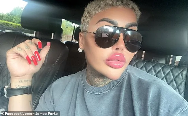 Two Arrested in Manslaughter Case of Botched Star 'The Lip King' as Cosmetic Surgery Link Probed