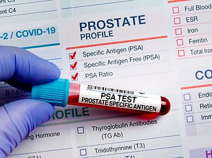 Geography Trumps Genetics: Southern Men Face Higher Prostate Cancer Death Rates.