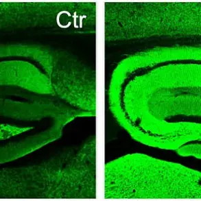 Breakthrough Herbal Treatment for Alzheimer's Emerges from Common Kitchen Herbs