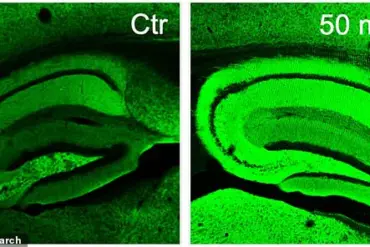 Breakthrough Herbal Treatment for Alzheimer's Emerges from Common Kitchen Herbs