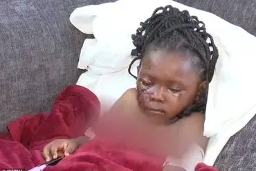 Five-Year-Old Girl Injured in Brutal Pit Bull Attack at Friend's Home in South Bend, Family Describes 'Unimaginable Horror'
